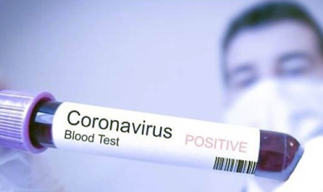 Virus Corona/ilustrasi 