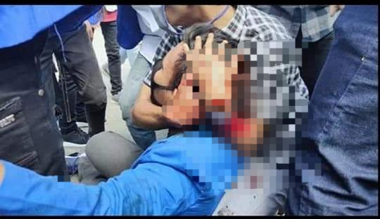 Aktivitas PMII Pamekasan yang menjadi korban pemukulan