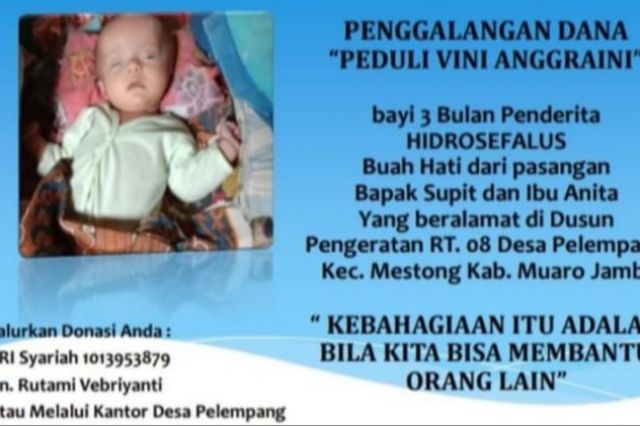 Didiagnosa Menderita Hidrosefalus Sejak Lahir, Vini Anggraini Butuh Uluran Tangan