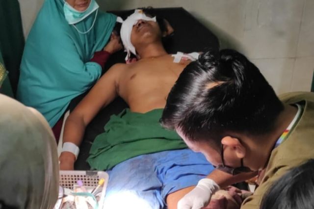 Pulang dari Kebun: Anggota BPD Muaro Jambi Diserang Beruang