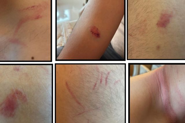 Anggota DPRD Provinsi Jambi Ini jadi Korban Pengeroyokan Mertua dan Istri