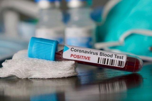 Pasien Positif Corona di Merangin Bertambah 5 Orang, Ini Alamatnya