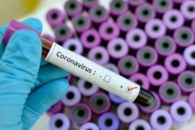 4 Warga Tebing Tinggi Kontak dengan Pasien 06, Dinyatakan Positif dari Hasil Rapid Test